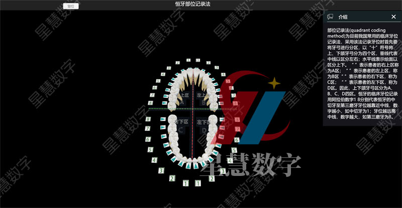 λ¼