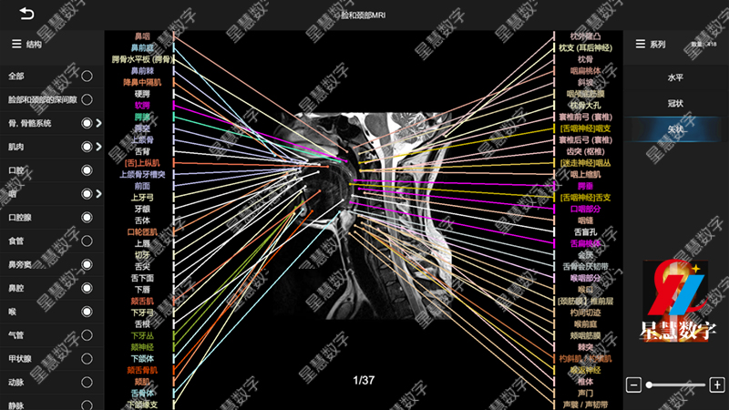 ͷ����MRI-ʸ״