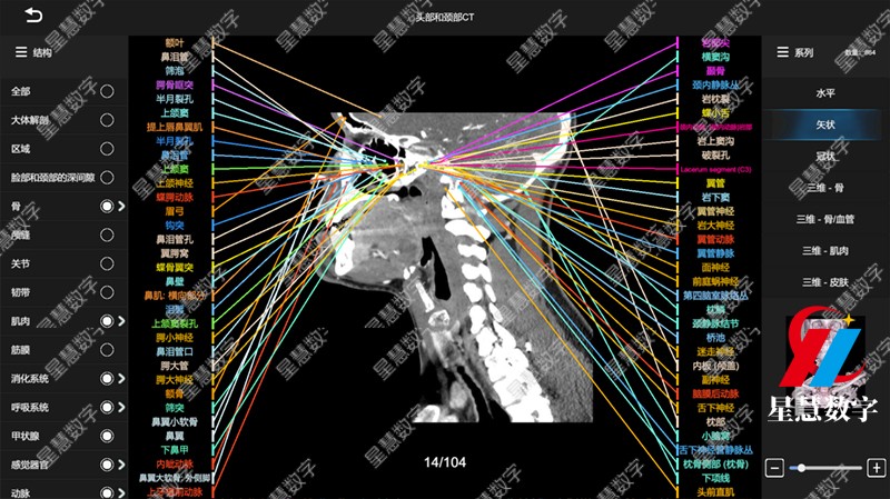 头部和颈部CT-矢状 头部和颈部CT-矢状
