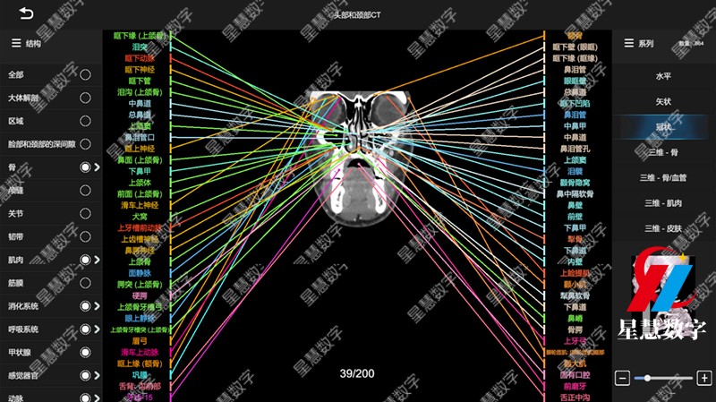 头部和颈部CT-冠状 头部和颈部CT-冠状