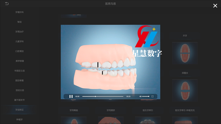 陶瓷托槽 陶瓷托槽