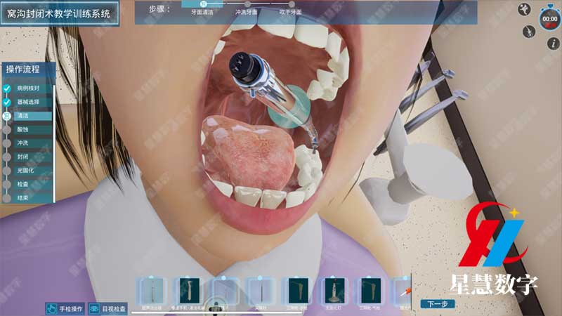 窝沟封闭术教学训练系统--操作流程 窝沟封闭术教学训练系统--操作流程