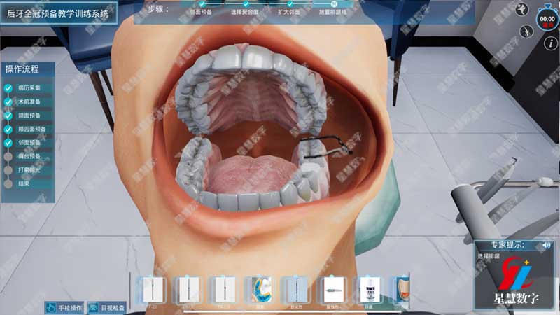 后牙全冠预备教学训练系统--放置排龈线 后牙全冠预备教学训练系统--放置排龈线