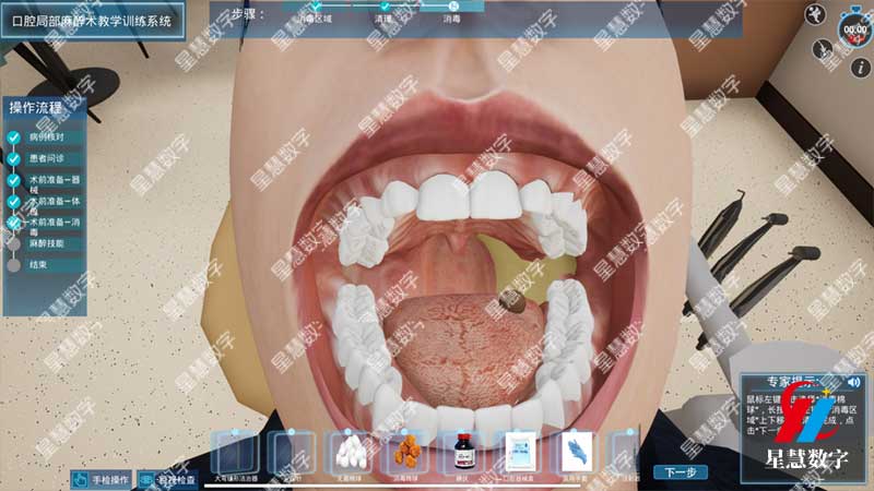 口腔局部麻醉术--消毒 口腔局部麻醉术--消毒