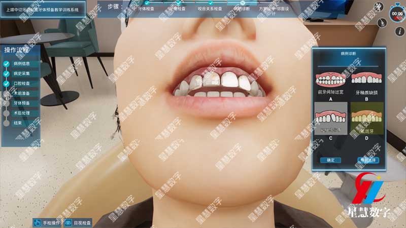 口腔检查 口腔检查