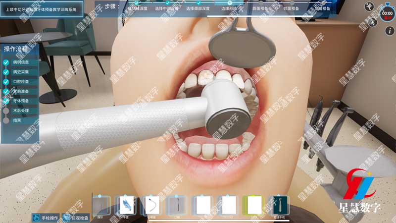 牙体预备 牙体预备