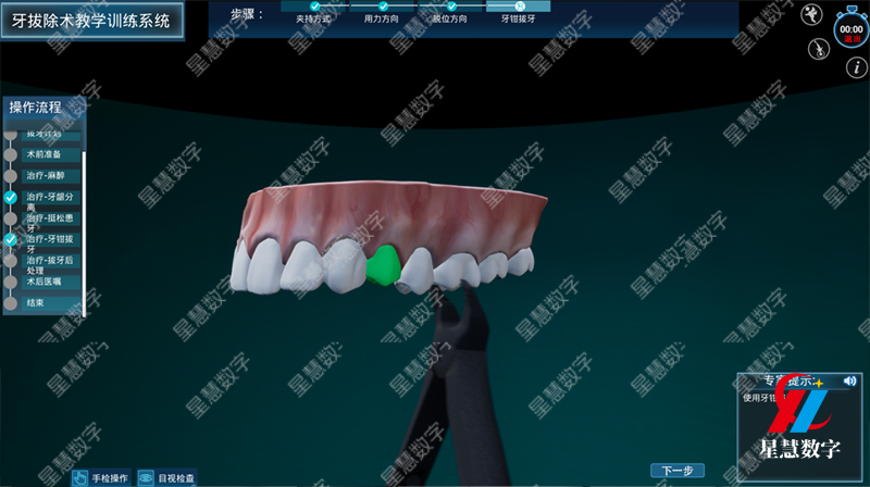 牙拔除术教学训练系统 牙拔除术教学训练系统