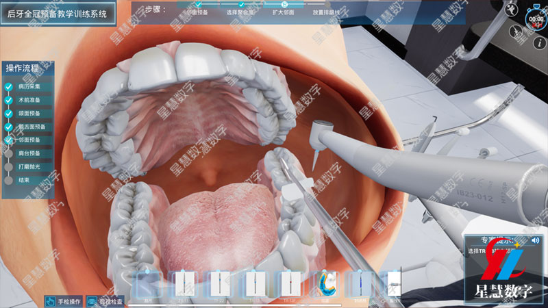 肩台预备 肩台预备