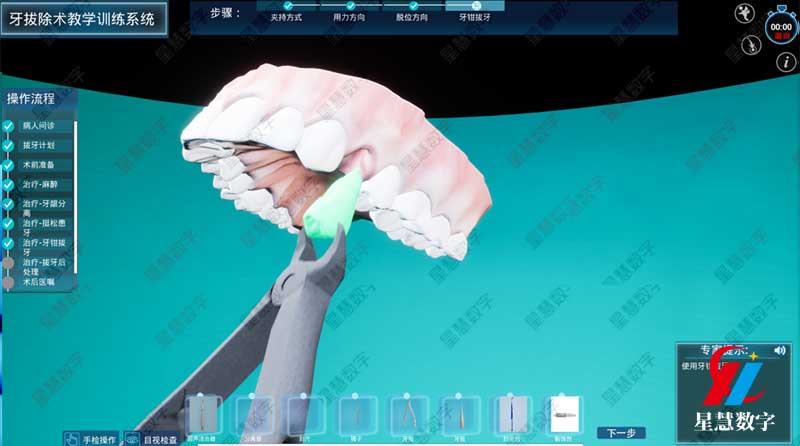 ��ǯ����