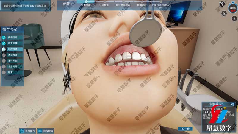 口腔检查 口腔检查