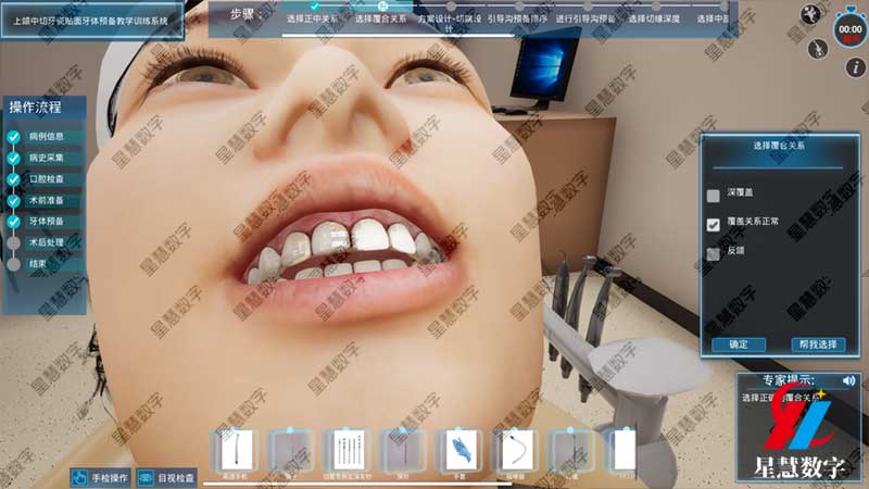 选择覆合关系 选择覆合关系