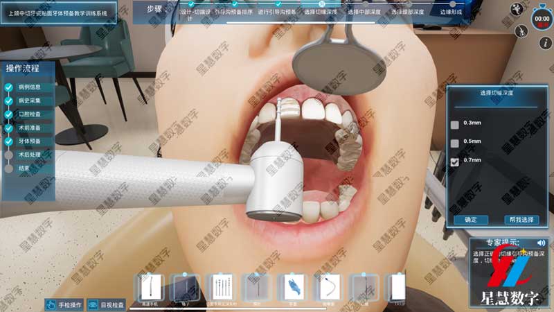 切端预备 切端预备