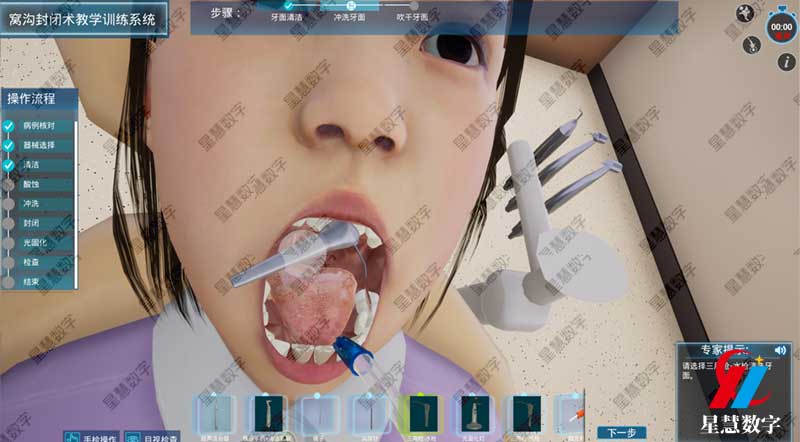 窝沟清洁 窝沟清洁