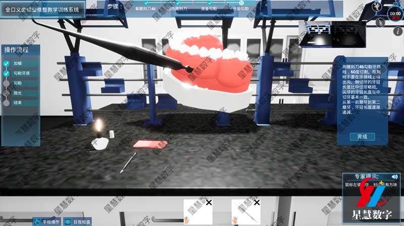 勾勒牙颈 勾勒牙颈