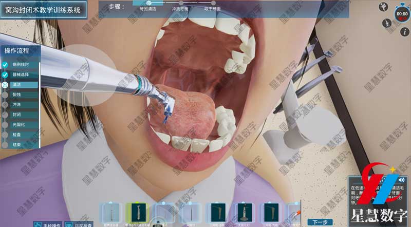 口腔清洁 口腔清洁